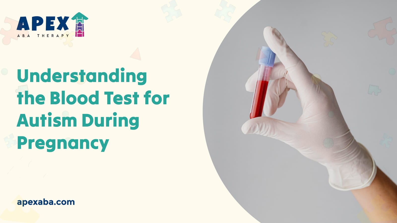 Understanding the Blood Test for Autism During Pregnancy