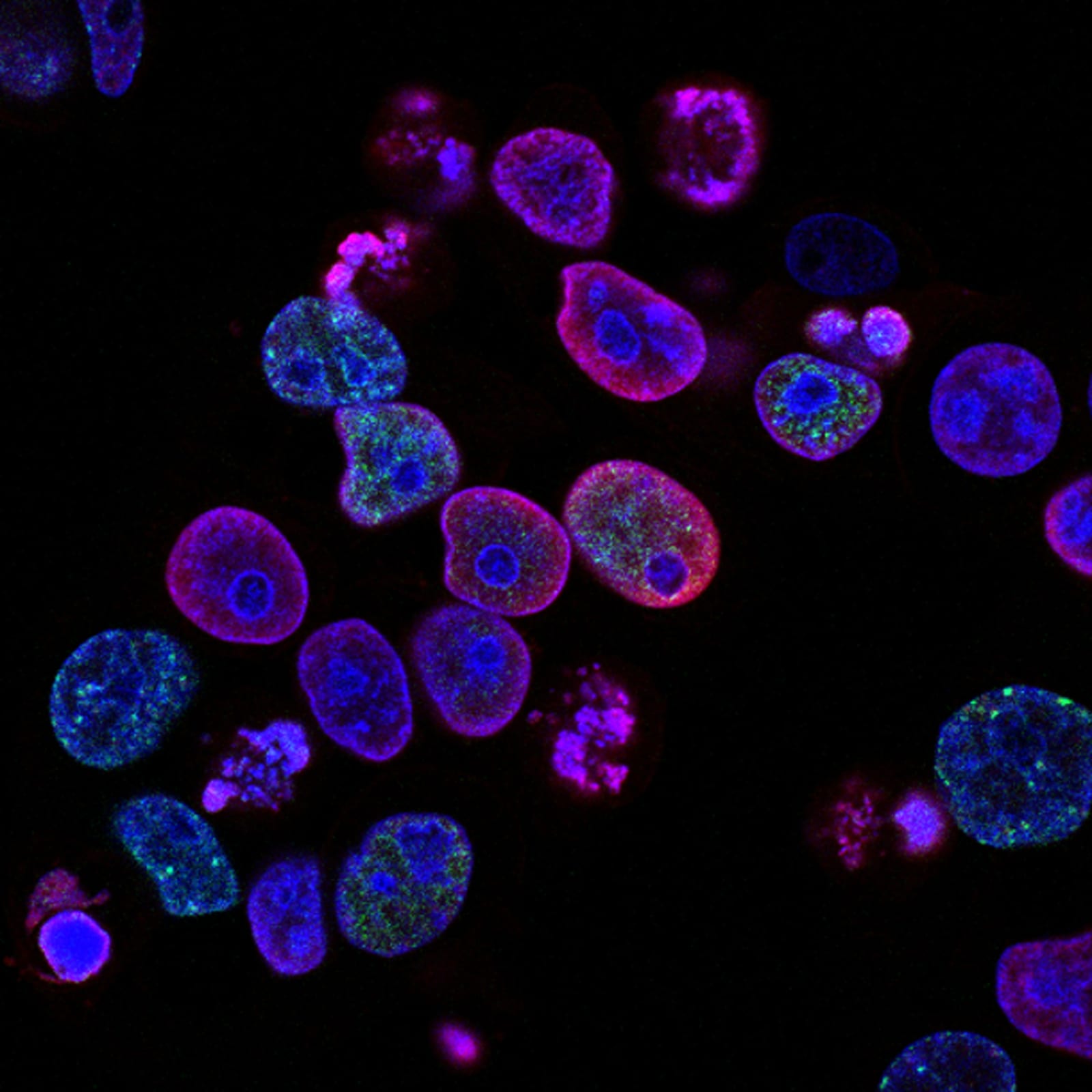 699306e0e9c8fae874fc71f5 656918cba977ca9a3533c00e national cancer institute L7en7Lb Ovc unsplash jpeg